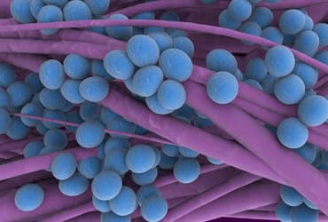 Strep A Test